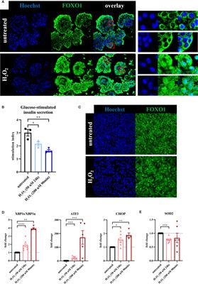 Oxidative Stress Leads to β-Cell Dysfunction Through Loss of β-Cell Identity